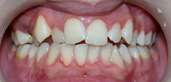 Ортодонтия (выравнивание зубов) - Стоматологическая клиника Железных